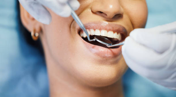 Best Emergency Dentist for Knocked-Out Tooth in Mount Pleasant, SC