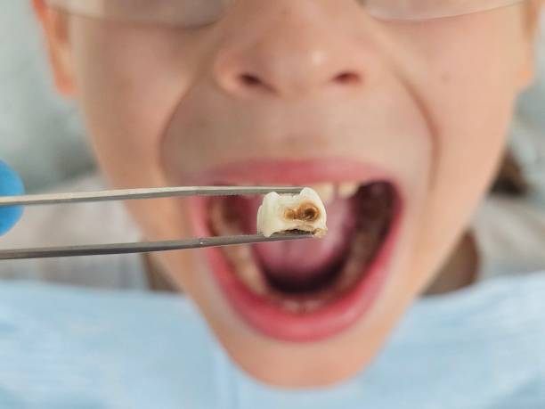 Best Urgent Dental Care for Toothache in Mount Pleasant, SC